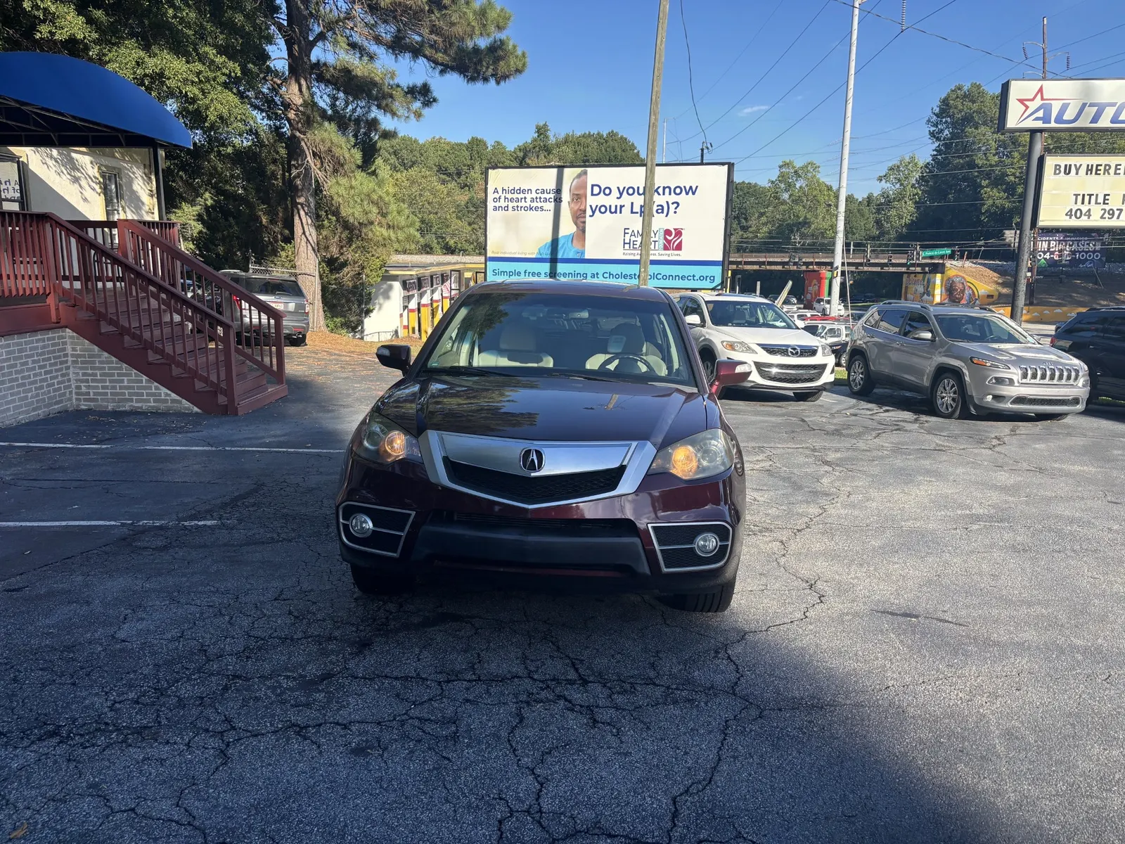 2011 ACURA RDX — photo 2
